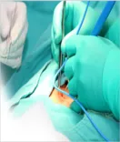 Surgical Gastro Enterology