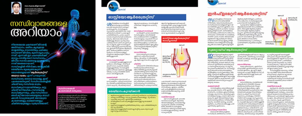 Arthritis Special Health Article by Starcare Hospitals