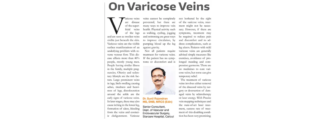 Varicose Veins Awareness